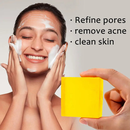 Velara Soap: Purify Your Pores and Reveal Your Natural Glow